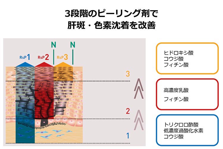 ピーリング図